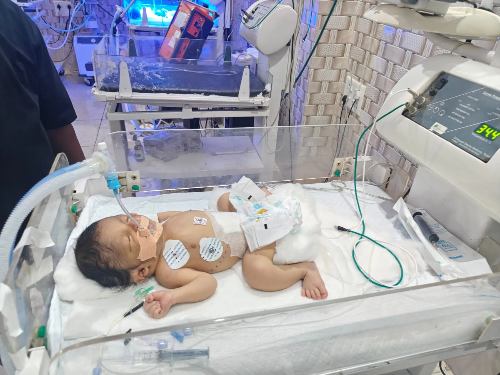 Close-up of NICU Incubator