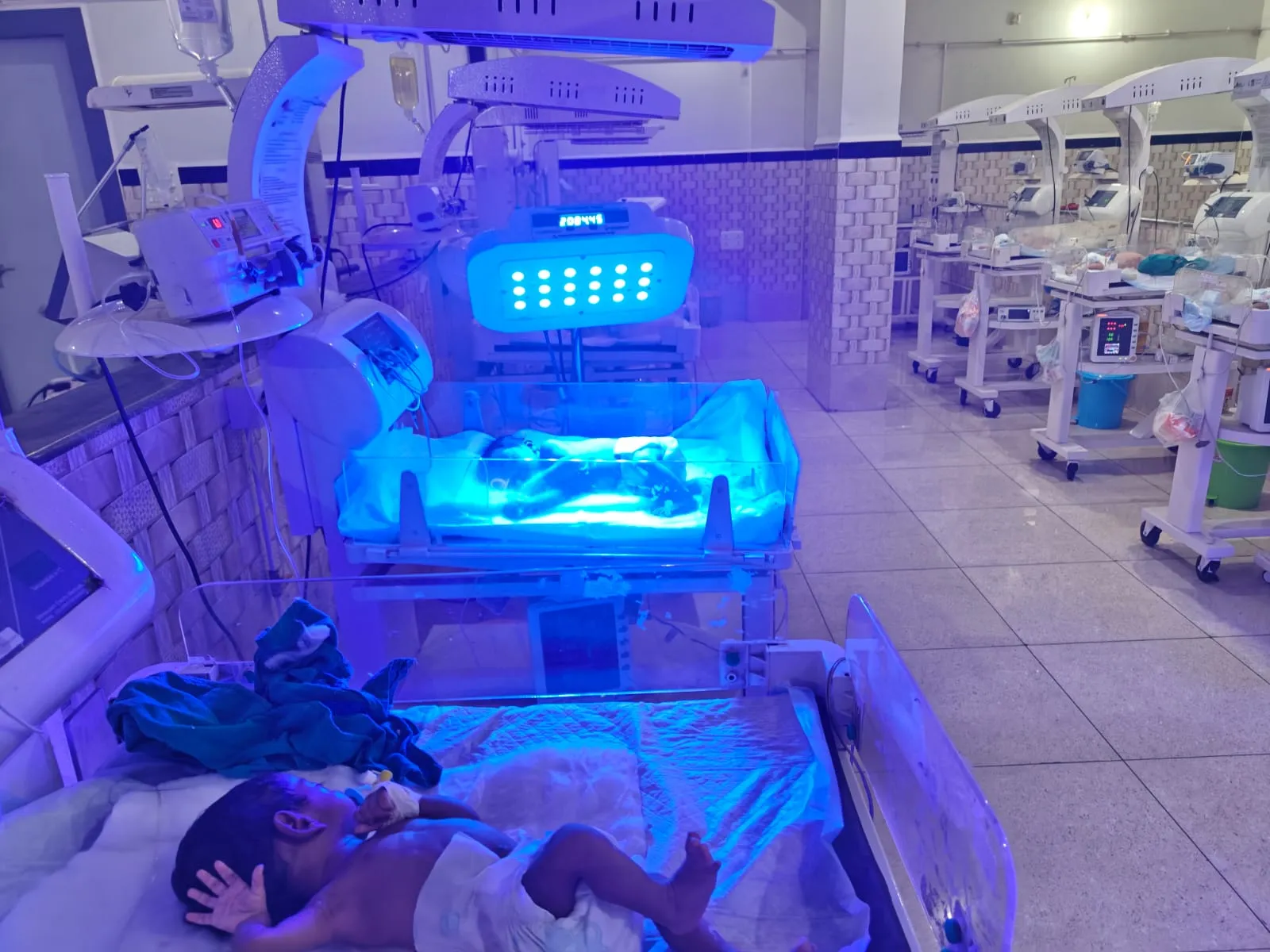 State-of-the-Art NICU Facilities